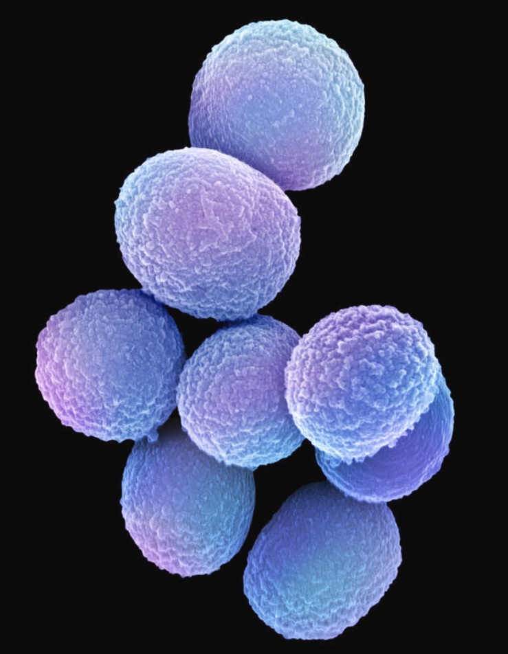 Staphylococcus aureus micrograph